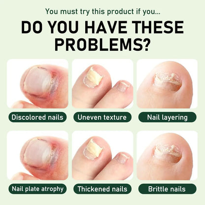 7-Day Nail Revive Serum