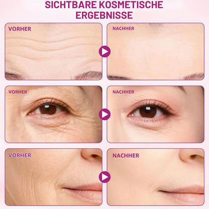 FACE WRINKLE TRIANGLE PATCH