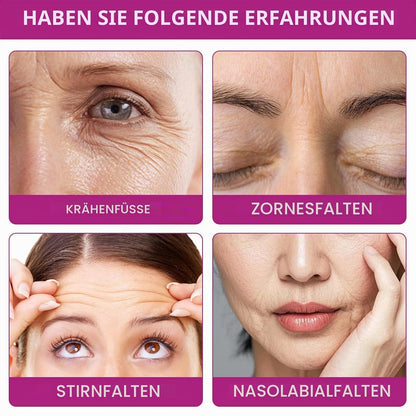 FACE WRINKLE TRIANGLE PATCH