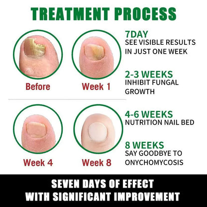 7-Day Nail Revive Serum